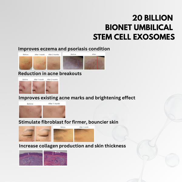 EXOSOME AMPOULE