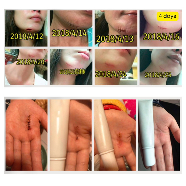 Bundle of 2: Radiance Ultimate Repair Serum